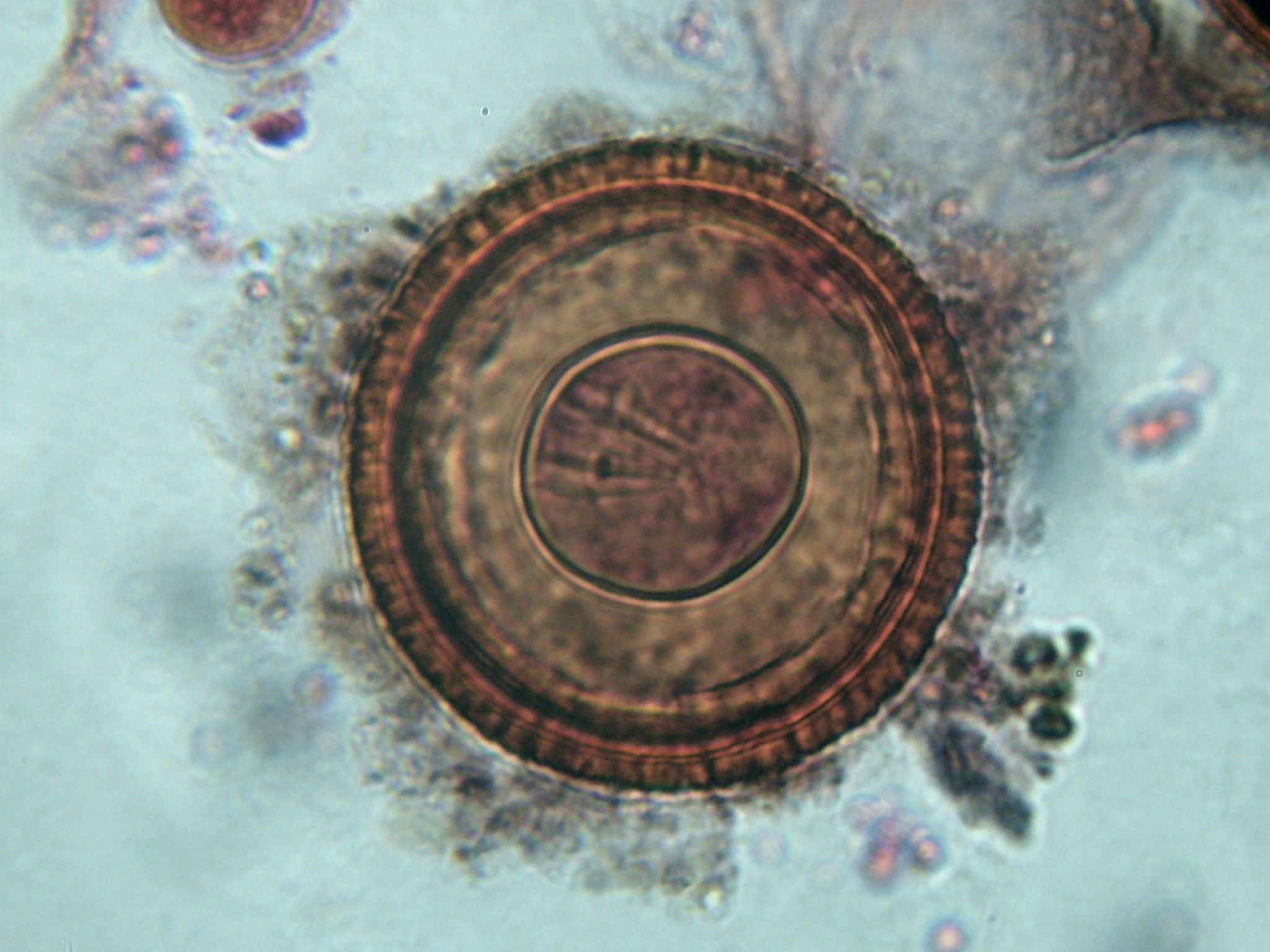 ワームはあなたが知らなくてもあなたの脳に住むことができます（そしてそれを防ぐ方法はここにあります）