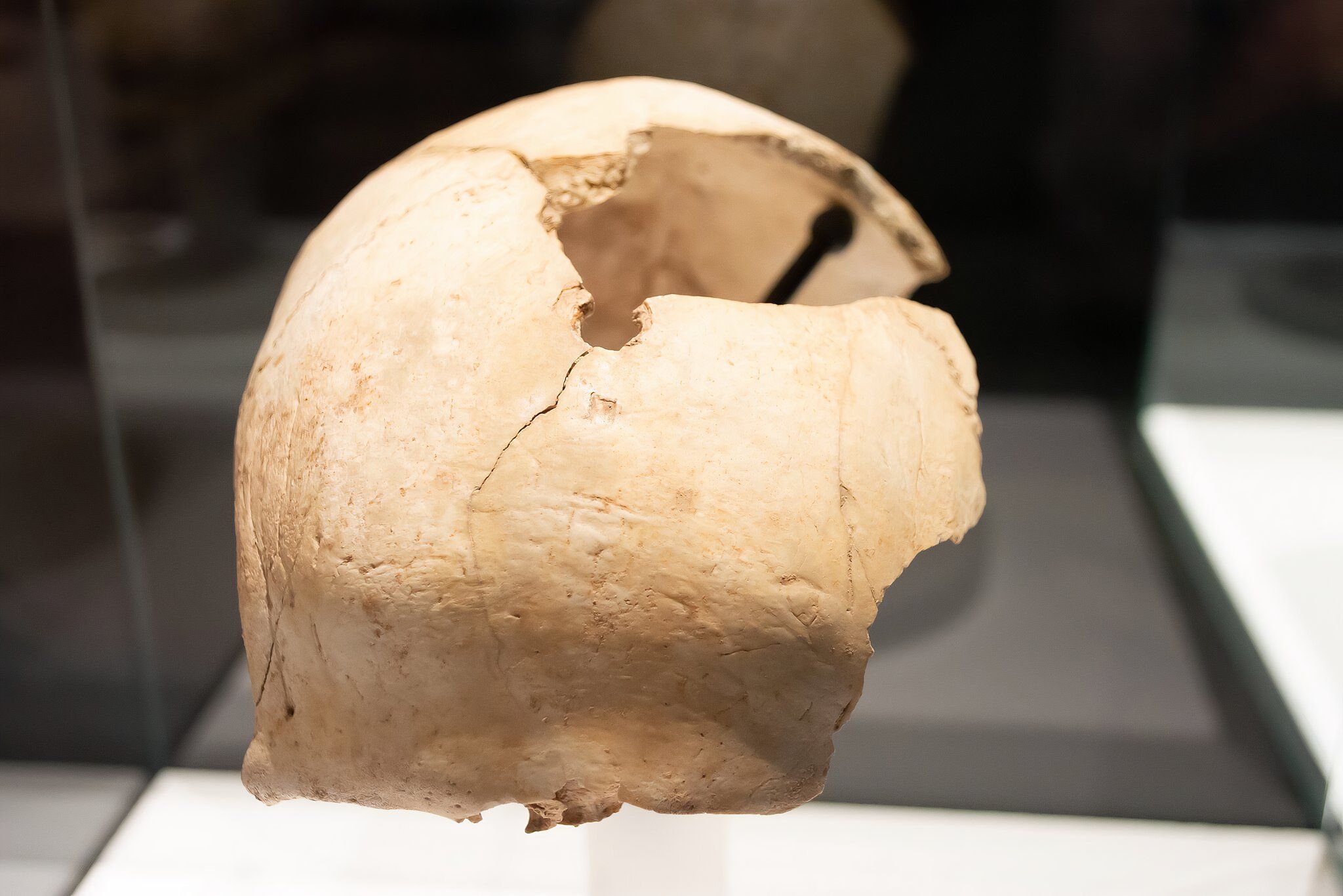 この古代文明がなぜ爪を人間の頭蓋骨に押し込んだのかをついに知っているかもしれません